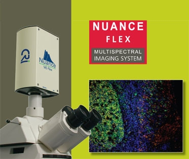 Nuance��(sh��)�H���VӰ�����VӰ��ϵ�y(t��ng)